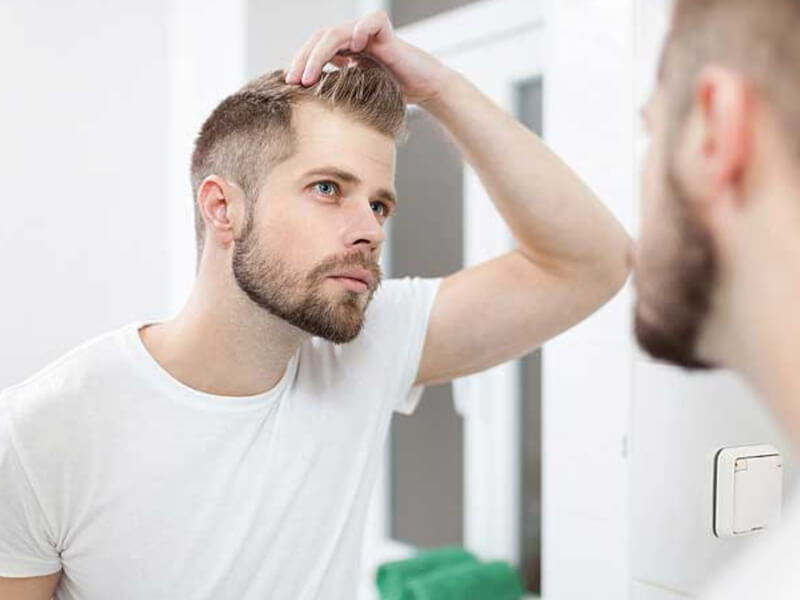 Protez Saç Bakımı Evde Yapılabilir Mi?