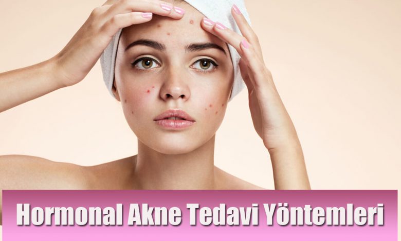 Hormonal Akne