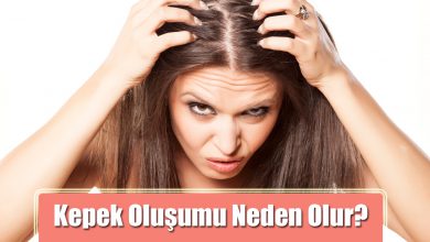 Kepek Oluşumu Neden Olur?