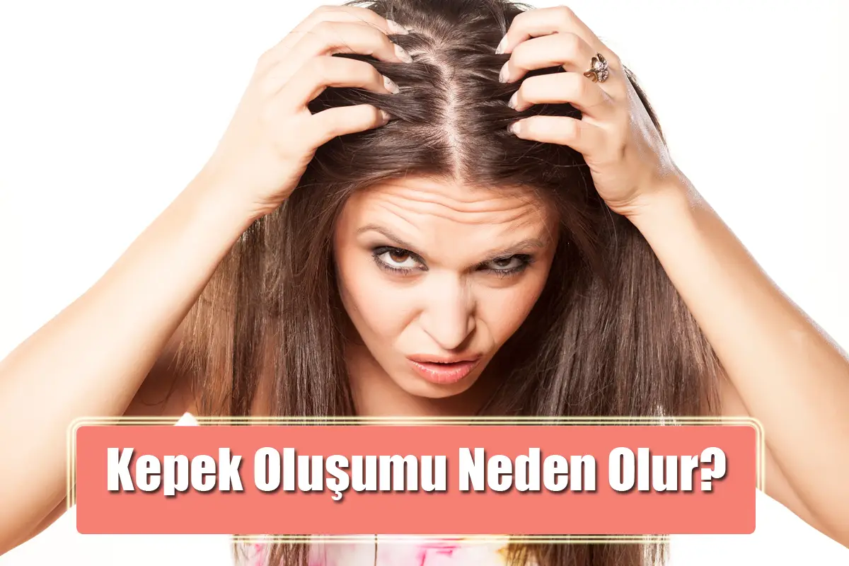 Kepek Oluşumu Neden Olur?
