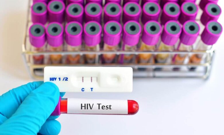 Hiv Testi