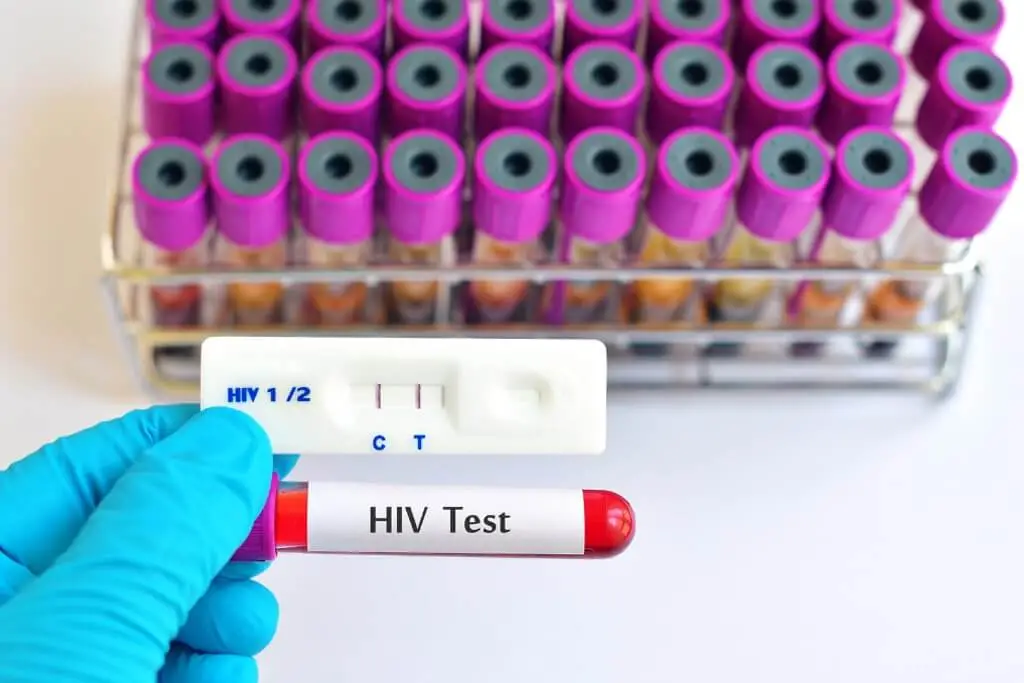 Hiv Testi Nedir? Neden Yapılır?