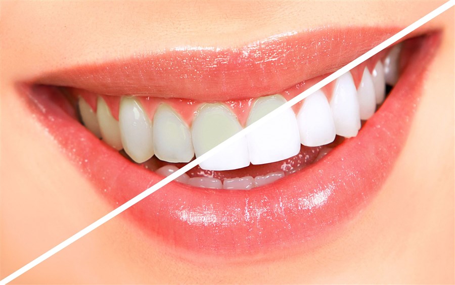 ağız ve diş bakımı nasıl yapılır