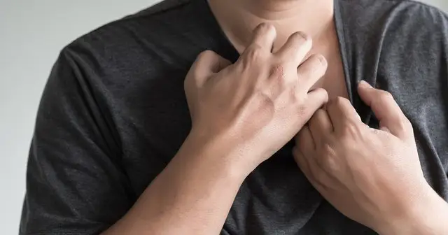 Egzama Kaşıntısına Ne İyi Gelir?