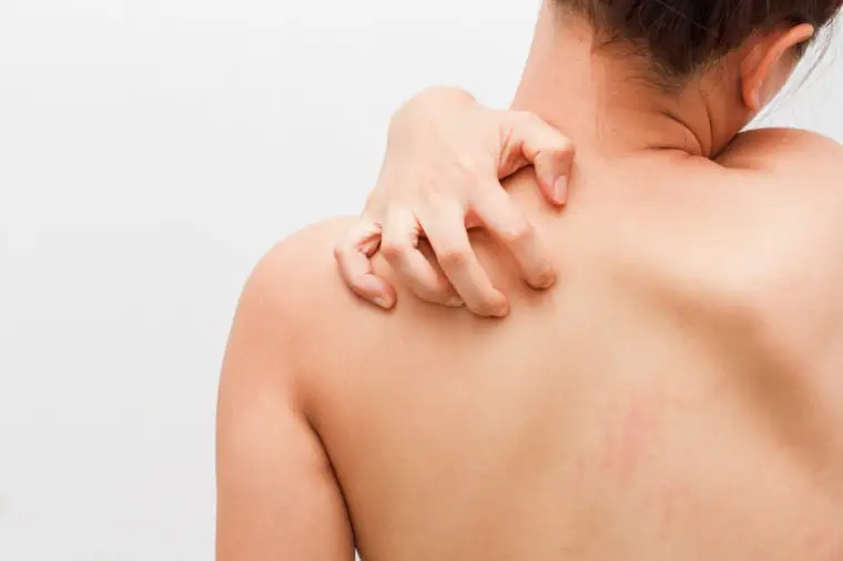 Bepanthol Sensiderm Krem Kaşıntıyı Nasıl Önler