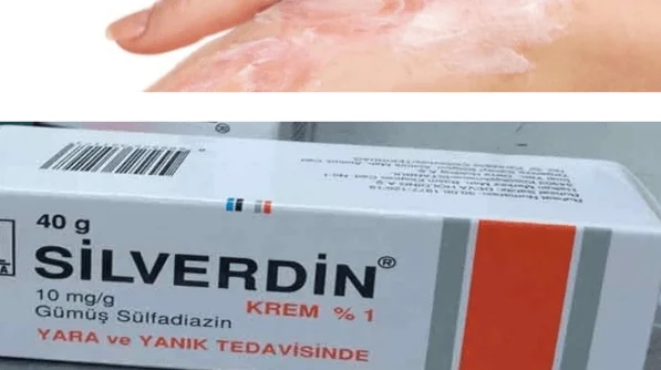 Silverdin Krem Ne İşe Yarar?